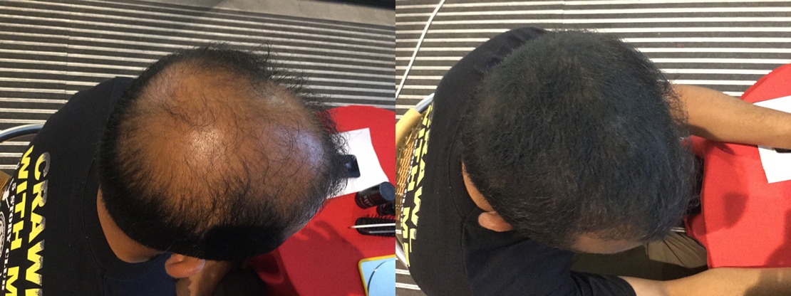 isman using toppik hair treatment malaysia